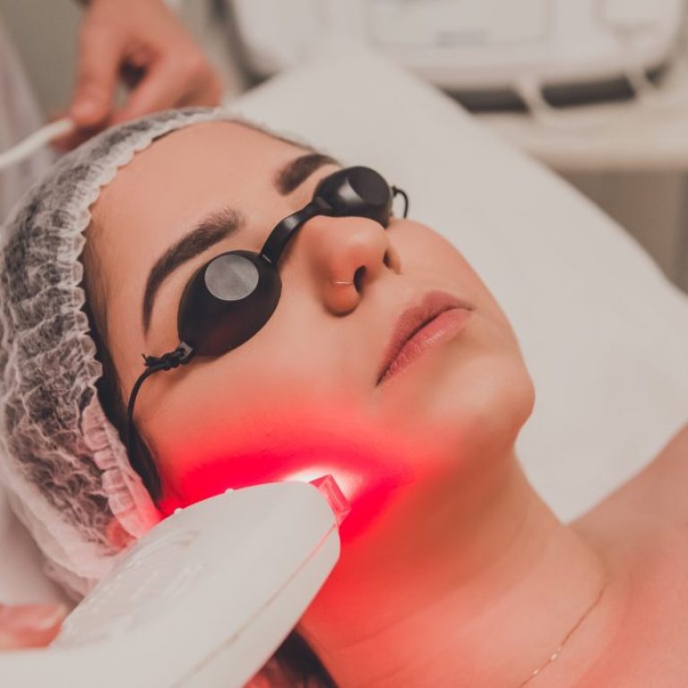 Pessoa deitada usando uma touca para proteger o cabelo e óculos de proteção sobre os olhos. Um profissional segura um dispositivo que emite uma luz vermelha, aplicando-o diretamente no rosto da pessoa. A cena ilustra um procedimento a laser, frequentemente utilizado em tratamentos estéticos e médicos, como rejuvenescimento da pele, remoção de manchas ou depilação.